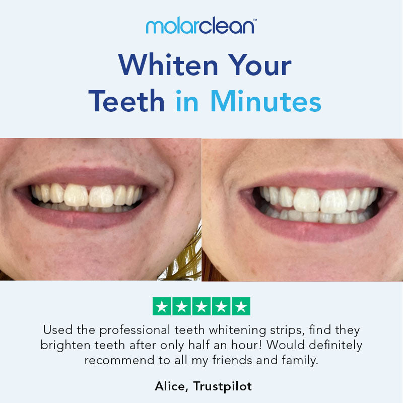 Teeth Whitening Strips